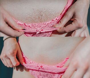 Brazilian Waxing (1)