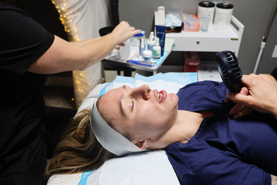 Chemical Peel Treatment